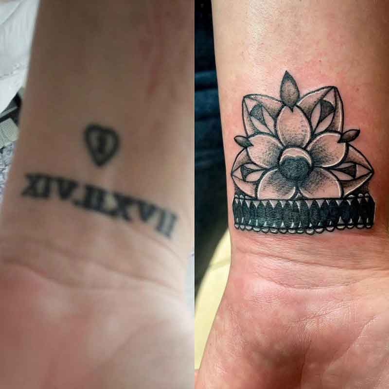 Mandala Cover Up Tattoo 1