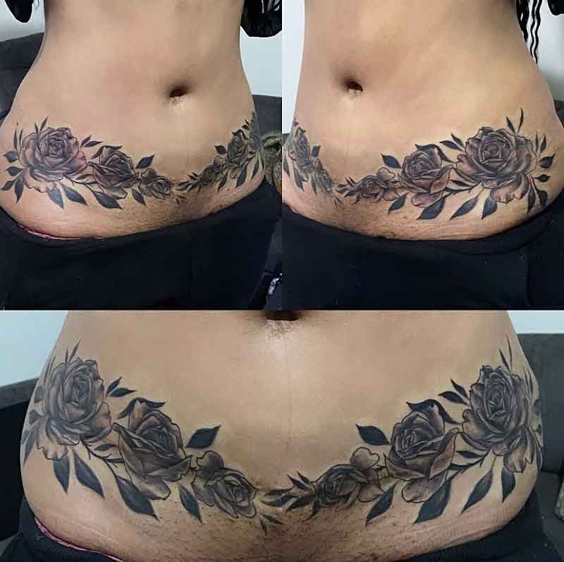 Tummy Tuck Cover Up Tattoo 1