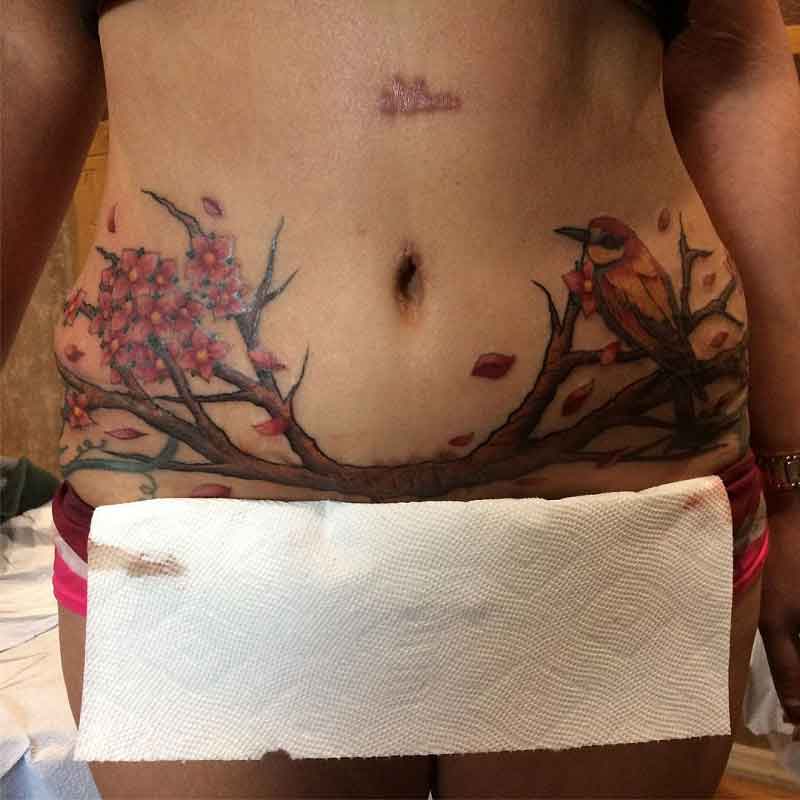 Tummy Tuck Cover Up Tattoo 3