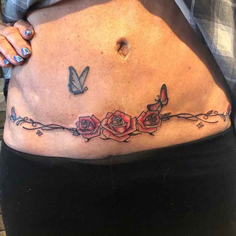 Butterfly Tummy Tuck Tattoo 2