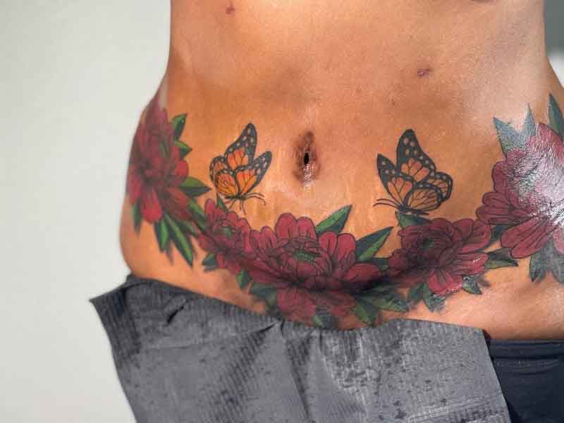 Butterfly Tummy Tuck Tattoo 4